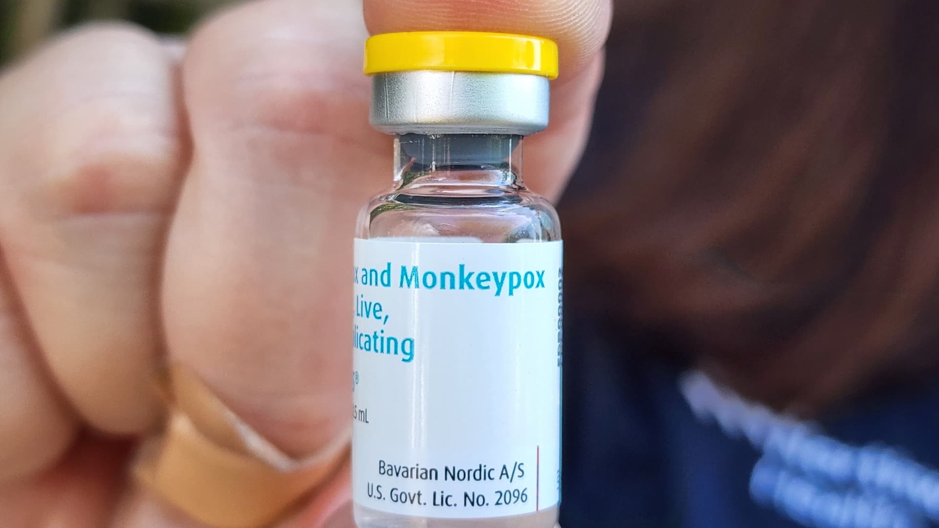 Biden administration pondering public health emergency in step with monkeypox outbreak
