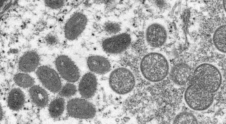 ICMR detects monkeypox virus stress A.2 among UAE travellers. What does it mean?