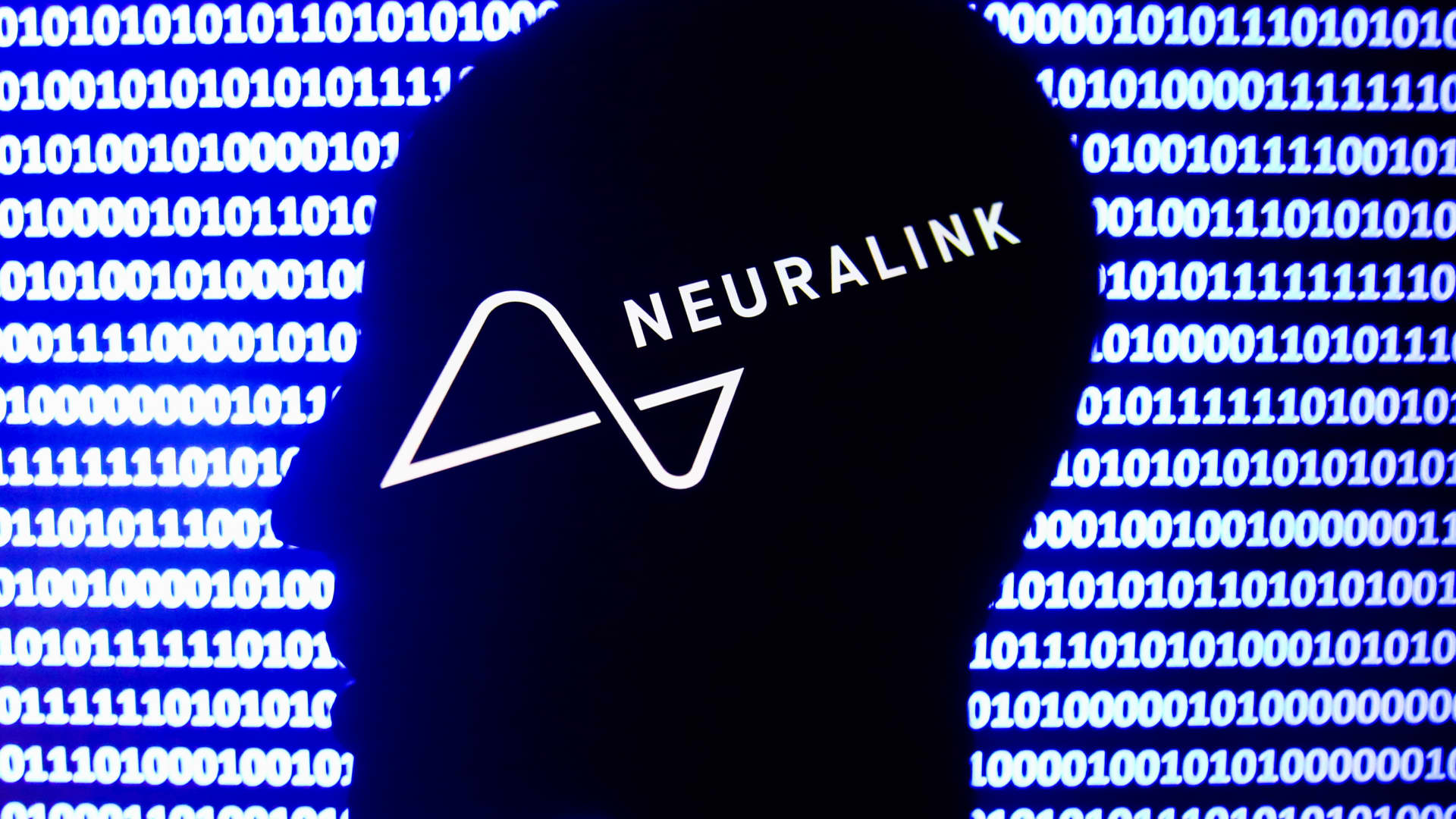 Elon Musk’s mind implant firm Neuralink announces FDA approval of in-human scientific seek